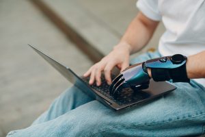 Person using laptop with prosthetic hand